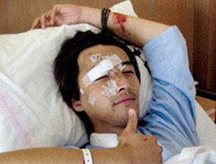 从仙剑到琅琊榜 胡歌残缺双眼皮怎么破!