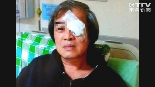 男子疑为诈保2200万 制造假车祸“戳瞎”左眼