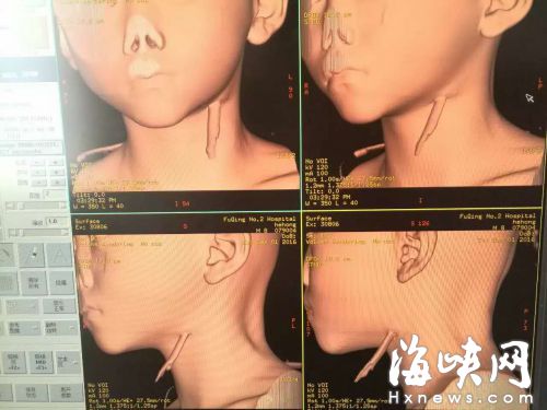 @@298475@@_A01_gc6922